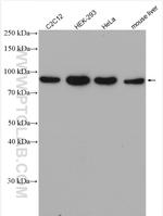 APPL1 Antibody in Western Blot (WB)