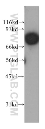 APPL1 Antibody in Western Blot (WB)