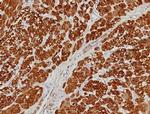 Calponin-1 (Smooth Muscle Marker) Antibody in Immunohistochemistry (Paraffin) (IHC (P))