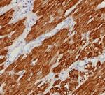 Calponin-1 (Smooth Muscle Marker) Antibody in Immunohistochemistry (Paraffin) (IHC (P))