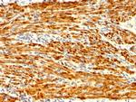 Calponin-1 Antibody in Immunohistochemistry (Paraffin) (IHC (P))