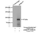 golgin 97 Antibody in Immunoprecipitation (IP)
