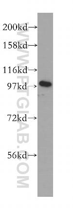 golgin 97 Antibody in Western Blot (WB)