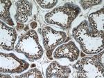 WDR16 Antibody in Immunohistochemistry (Paraffin) (IHC (P))