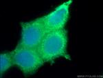 SIAH2 Antibody in Immunocytochemistry (ICC/IF)