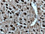 SIAH2 Antibody in Immunohistochemistry (Paraffin) (IHC (P))