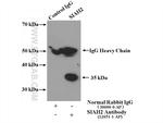SIAH2 Antibody in Immunoprecipitation (IP)