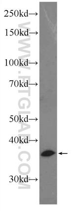 SIAH2 Antibody in Western Blot (WB)