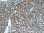 TMEM16A/DOG1 Antibody in Immunohistochemistry (Paraffin) (IHC (P))