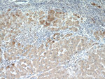 TMEM16A/DOG1 Antibody in Immunohistochemistry (Paraffin) (IHC (P))