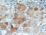 TMEM16A/DOG1 Antibody in Immunohistochemistry (Paraffin) (IHC (P))