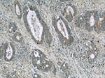 TMEM16A/DOG1 Antibody in Immunohistochemistry (Paraffin) (IHC (P))