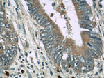 TMEM16A/DOG1 Antibody in Immunohistochemistry (Paraffin) (IHC (P))