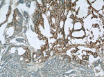 TMEM16A/DOG1 Antibody in Immunohistochemistry (Paraffin) (IHC (P))