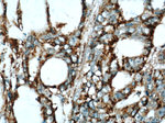 TMEM16A/DOG1 Antibody in Immunohistochemistry (Paraffin) (IHC (P))