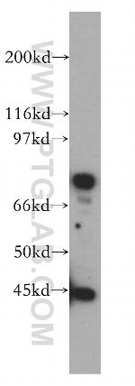 IL5RA Antibody in Western Blot (WB)