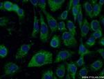 P4HA1 Antibody in Immunocytochemistry (ICC/IF)