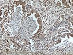 P4HA1 Antibody in Immunohistochemistry (Paraffin) (IHC (P))