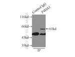 P4HA1 Antibody in Immunoprecipitation (IP)