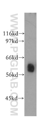 P4HA1 Antibody in Western Blot (WB)