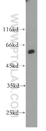 P4HA1 Antibody in Western Blot (WB)