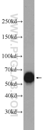 P4HA1 Antibody in Western Blot (WB)