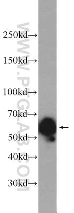 P4HA1 Antibody in Western Blot (WB)