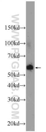 P4HA1 Antibody in Western Blot (WB)