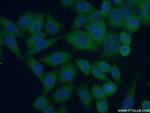 IkB beta Antibody in Immunocytochemistry (ICC/IF)