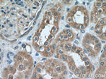 IkB beta Antibody in Immunohistochemistry (Paraffin) (IHC (P))