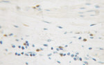 IkB beta Antibody in Immunohistochemistry (Paraffin) (IHC (P))