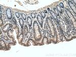 IkB beta Antibody in Immunohistochemistry (Paraffin) (IHC (P))