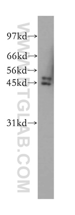 IkB beta Antibody in Western Blot (WB)