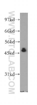 IkB beta Antibody in Western Blot (WB)