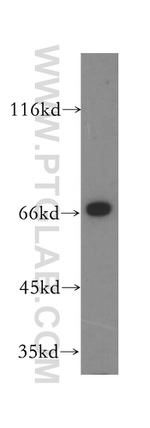 IMP5 Antibody in Western Blot (WB)