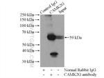 CaMKII gamma Antibody in Immunoprecipitation (IP)