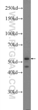 CaMKII gamma Antibody in Western Blot (WB)