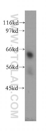 TULP2 Antibody in Western Blot (WB)