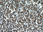 SHCBP1 Antibody in Immunohistochemistry (Paraffin) (IHC (P))