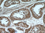 SHCBP1 Antibody in Immunohistochemistry (Paraffin) (IHC (P))