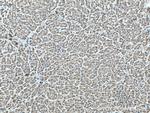 SHCBP1 Antibody in Immunohistochemistry (Paraffin) (IHC (P))