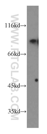 SHCBP1 Antibody in Western Blot (WB)