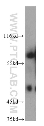 SHCBP1 Antibody in Western Blot (WB)