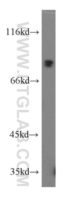 SHCBP1 Antibody in Western Blot (WB)