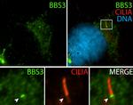 BBS3 Antibody in Immunocytochemistry (ICC/IF)