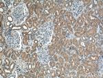 BBS3 Antibody in Immunohistochemistry (Paraffin) (IHC (P))