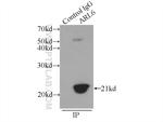 BBS3 Antibody in Immunoprecipitation (IP)