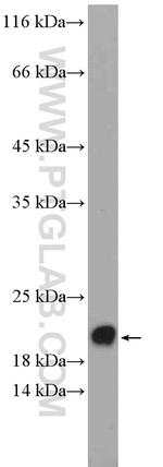 BBS3 Antibody in Western Blot (WB)