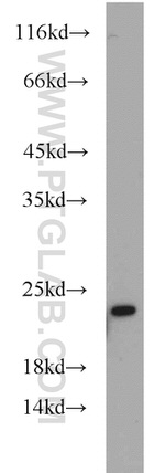 BBS3 Antibody in Western Blot (WB)