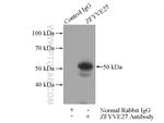 ZFYVE27 Antibody in Immunoprecipitation (IP)